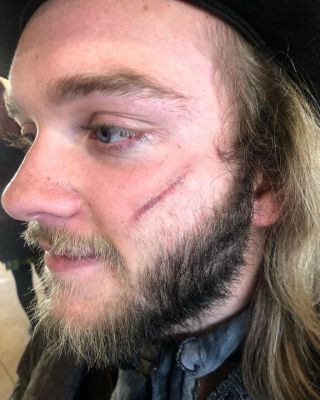 A scar I did using highlight and shadow alcohol colors. COME TO EVERMORE BEFORE LORE SEASON IS OVER. I PROMISE ITS FUCKIN MAGICAL YALL.  @ Evermore Park